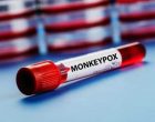 US reports over 17,000 monkeypox cases