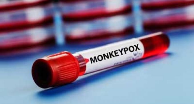 US reports over 17,000 monkeypox cases